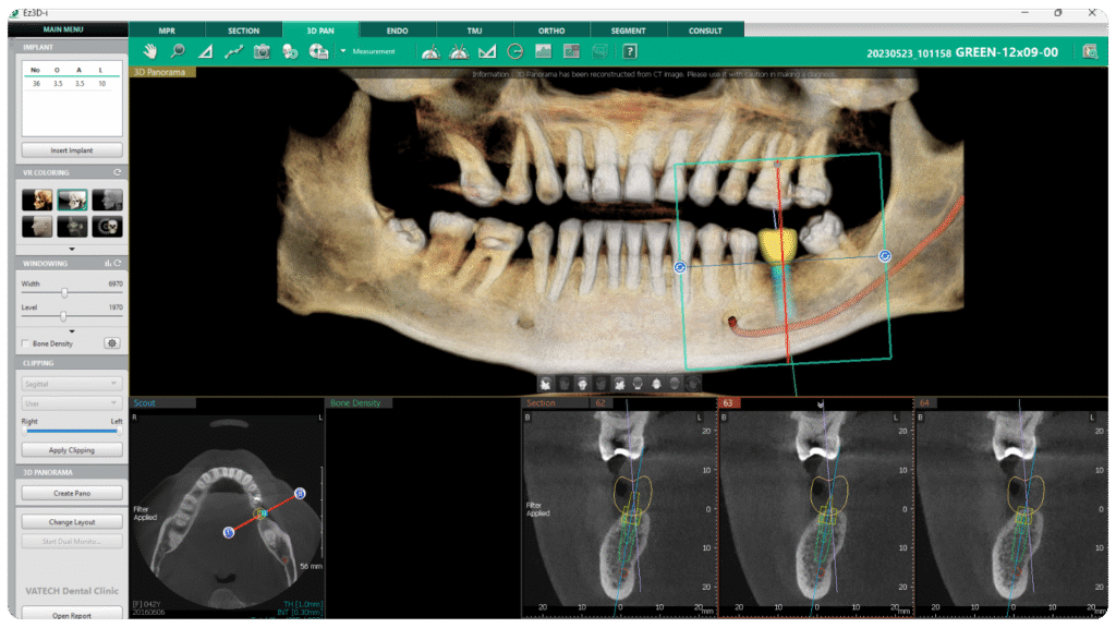 3D Panoramic Image