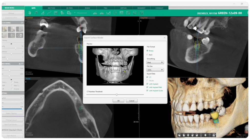 CADCAM